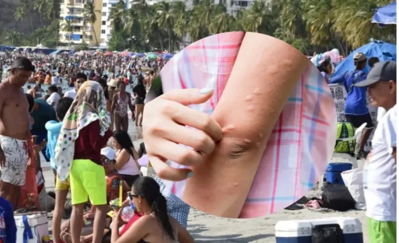 Bathers informa brotes en la piel después de ingresar al mar en Santa Marta; La mujer afectada le dice su experiencia

 – Tinta clara