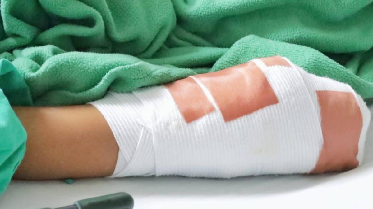 Nuevos detalles del habitante del habitante de la calle que prendieron fuego después de una discusión en Medellín: «Hubiera reclamado»

 – Tinta clara