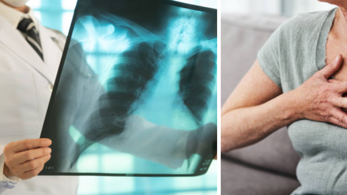 El DADIS informa más de 300 casos de tuberculosis hasta 2025

 – Tinta clara