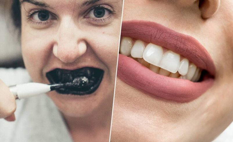 La peligrosa moda de tiktok que puede destruir tu sonrisa

 – Tinta clara