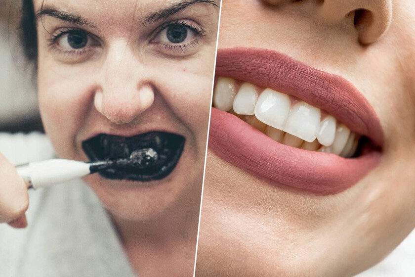 La peligrosa moda de tiktok que puede destruir tu sonrisa

 – Tinta clara