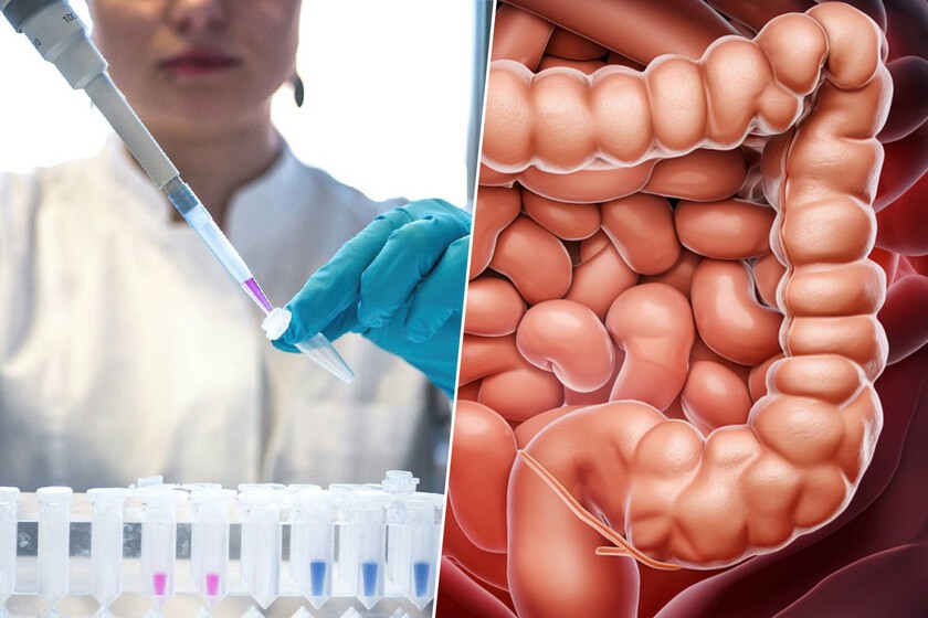 Los cánceres de colon están aumentando de manera alarmante entre los jóvenes. Tenemos un sospechoso: el sedentarismo
 – Tinta clara