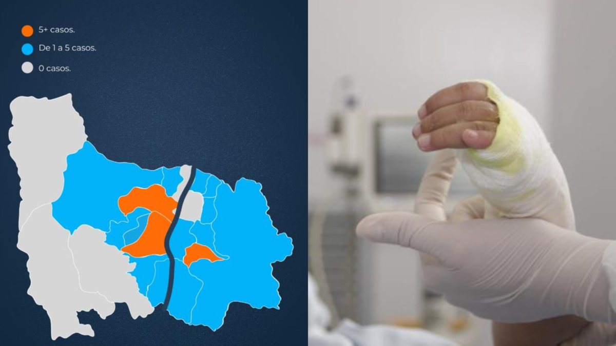 Tres comunas de Medellín representan la mayoría de las quemas de pólvora en la ciudad hasta la fecha; Los casos han aumentado un 45% respecto a 2024.

 – Tinta clara