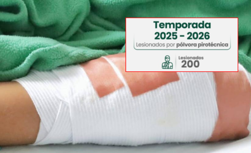 Antioquia llegó a 200 quemados por pólvora: es la mayor cifra de heridos en el departamento en la última década: Medellín registra 79 casos

 – Tinta clara