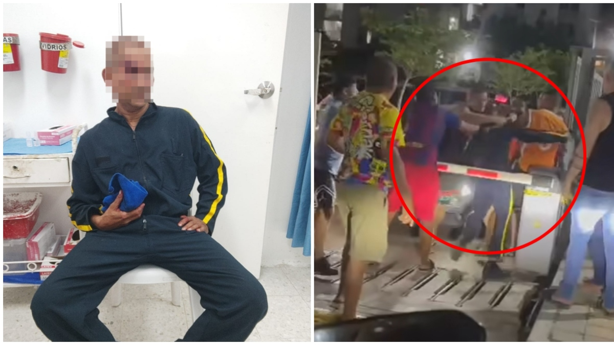 «Fue salvajemente atacado»

 – Tinta clara