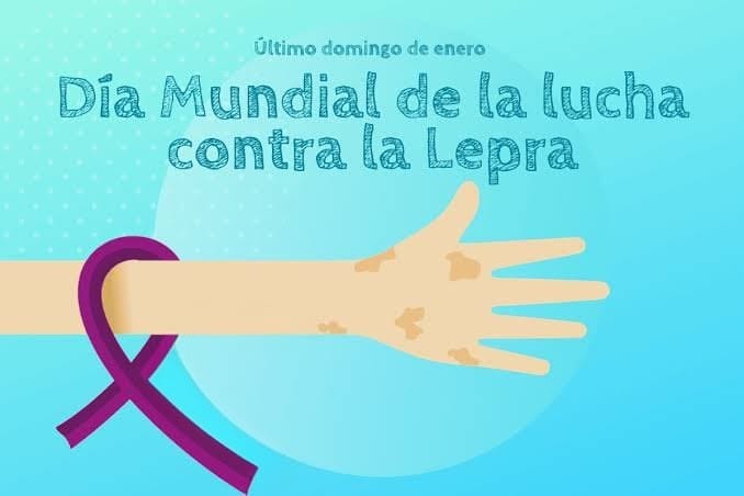 La lepra existe, también el estigma: una fecha para reflexionar – EXTRA

 – Tinta clara