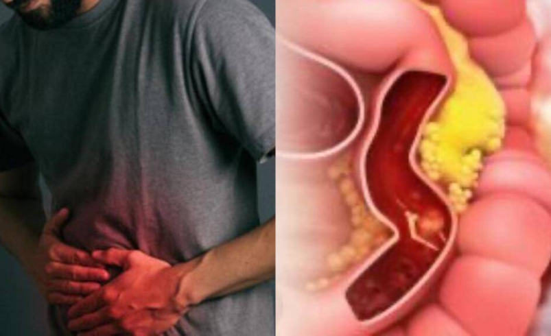 Estas son las formas de prevenir esta enfermedad

 – Tinta clara